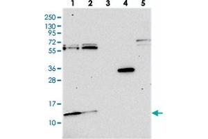 Western blot analysis of Lane 1: RT-4, Lane 2: U-251 MG, Lane 3: Human Plasma, Lane 4: Liver, Lane 5: Tonsil with MRP63 polyclonal antibody . (MRP63 Antikörper)