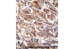 Immunohistochemistry (IHC) image for anti-F-Box and WD Repeat Domain Containing 12 (FBXW12) antibody (ABIN2995589) (FBXW12 Antikörper)