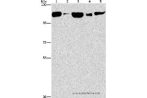 Western blot analysis of Raji cell and human fetal liver tissue, NIH/3T3 cell and mouse brain tissue, hela cell, using DNM2 Polyclonal Antibody at dilution of 1:400 (DNM2 Antikörper)