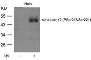 Image no. 1 for anti-Mitogen-Activated Protein Kinase Kinase 1 (MAP2K1) (pSer218), (pSer221) antibody (ABIN196944) (MEK1 Antikörper  (pSer218, pSer221))