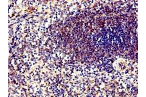 Immunohistochemistry of paraffin-embedded human spleen tissue using ABIN7169292 at dilution of 1:100 (PPP6C Antikörper  (Catalytic Subunit))