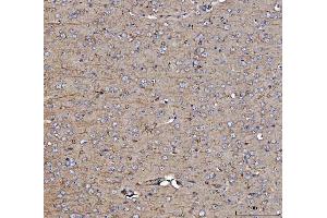 IHC analysis of Dkk1 using anti-Dkk1 antibody (ABIN7602383).