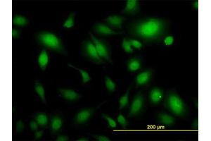 Image no. 1 for anti-Ubiquitin Specific Peptidase 34 (USP34) (AA 3296-3396) antibody (ABIN599094) (USP34 Antikörper  (AA 3296-3396))