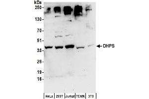 anti-Deoxyhypusine Synthase (DHPS) (AA 319-369) antibody