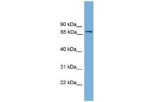 WB Suggested Anti-Ifi204 Antibody Titration:  0. (Ifi204 Antikörper  (Middle Region))