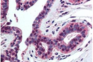 Human Breast (formalin-fixed, paraffin-embedded) stained with Histone H4 antibody ABIN294329 at 5 ug/ml followed by biotinylated goat anti-rabbit IgG secondary antibody ABIN481713, alkaline phosphatase-streptavidin and chromogen. (Histone H4 Antikörper  (AA 15-30))