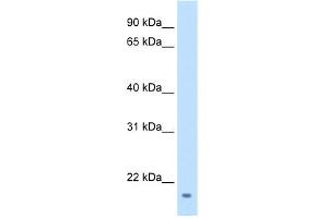 WB Suggested Anti-FAM107A Antibody Titration:  1 ug/ml  Positive Control:  Transfected 293T (FAM107A Antikörper  (Middle Region))