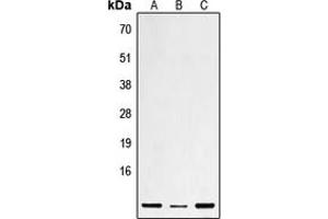 Western blot analysis of Defensin beta 1 expression in HEK293T (A), mouse liver (B), rat heart (C) whole cell lysates.