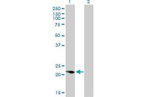 Western Blot analysis of CAPS expression in transfected 293T cell line by CAPS monoclonal antibody (M01), clone 4C6. (Calcyphosine Antikörper  (AA 1-109))