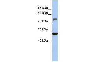 Human HeLa; WB Suggested Anti-ZSCAN20 Antibody Titration: 0. (ZSCAN20 Antikörper  (Middle Region))