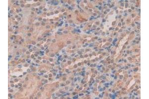 IHC-P analysis of Mouse Kidney Tissue, with DAB staining. (Peroxiredoxin 2 Antikörper  (AA 6-164))