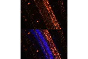 Immunofluorescence analysis of mouse eye using KCNS2 Polyclonal Antibody (ABIN7269478) at dilution of 1:100 (20x lens). (KCNS2 Antikörper  (AA 1-187))