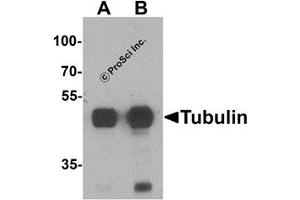Western Blotting (WB) image for anti-alpha Tubulin (TUBA1) (N-Term) antibody (ABIN1077421) (alpha Tubulin Antikörper  (N-Term))