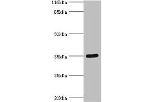 Western blot All lanes: SULT1B1 antibody at 24 μg/mL + Mouse small intestine tissue Secondary Goat polyclonal to rabbit IgG at 1/10000 dilution Predicted band size: 35 kDa Observed band size: 35 kDa (SULT1B1 Antikörper  (AA 1-271))