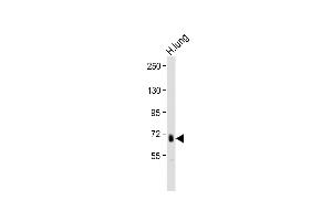Anti-ADTS4 Antibody (C-term) at 1:2000 dilution + Human lung lysate Lysates/proteins at 20 μg per lane.