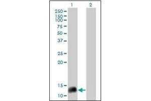 Western Blotting (WB) image for anti-Neuropeptide Y (NPY) antibody (ABIN953679) (NPY Antikörper)