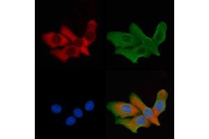 ABIN6260012 and ABIN6279137 staining HepG2 cells by IF/ICC. (AQP6 Antikörper  (Internal Region))