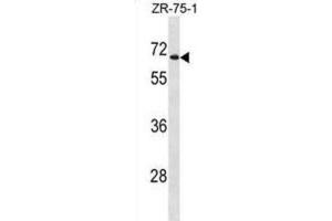 Western Blotting (WB) image for anti-UDP Glucuronosyltransferase 2 Family, Polypeptide B28 (UGT2B28) antibody (ABIN5020770) (UGT2B28 Antikörper)