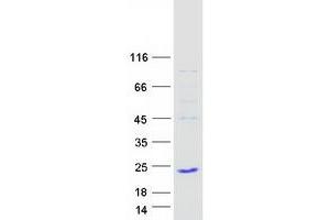 Western Blotting (WB) image for TAF12 RNA Polymerase II, TATA Box Binding Protein (TBP)-Associated Factor, 20kDa (TAF12) (Transcript Variant 2) protein (Myc-DYKDDDDK Tag) (ABIN2733193)