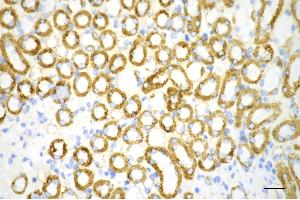 Immunohistochemistry was performed on paraffin-embedded mouse kidney using ATP5B antibody (ABIN7797681), 1:100).