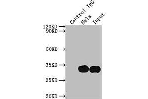 Immunoprecipitating LGALS3 in Hela whole cell lysate Lane 1: Rabbit control IgG instead of ABIN7127508 in Hela whole cell lysate. (Rekombinanter Galectin 3 Antikörper)