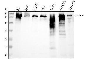 Western blot analysis of TLN1 using anti-TLN1 antibody (ABIN7600228).