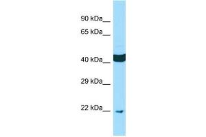 WB Suggested Anti-SCAMP4 Antibody Titration: 1. (SCAMP4 Antikörper  (N-Term))
