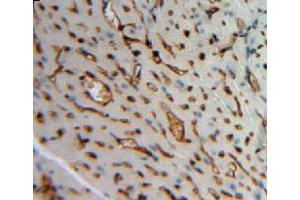 Used in DAB staining on fromalin fixed paraffin-embedded heart tissue (Angiopoietin 4 Antikörper  (AA 270-490))
