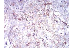 Immunohistochemistry (IHC) image for anti-Cadherin 11 (CDH11) (AA 468-617) antibody (ABIN5542424)