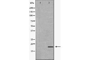 Western blot analysis of extracts of hela , using IL17A antibody. (Interleukin 17a Antikörper  (Internal Region))