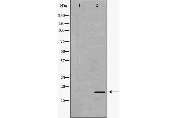 Interleukin 17a Antikörper  (Internal Region)