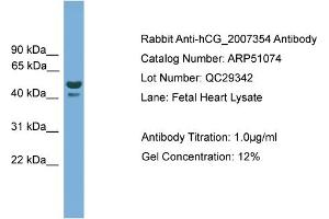 WB Suggested Anti-hCG_2007354  Antibody Titration: 0. (hCG_2007354 (N-Term) Antikörper)