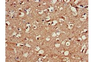 Immunohistochemistry of paraffin-embedded human brain tissue using ABIN7161445 at dilution of 1:100 (Neuroserpin Antikörper  (AA 191-240))