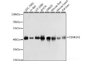 Western blot analysis of extracts of various cell lines using CSNK2A1 Polyclonal Antibody at dilution of 1:1000. (CSNK2A1/CK II alpha Antikörper)