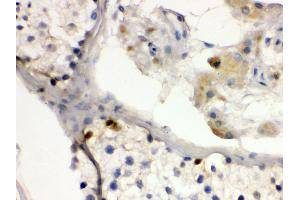 Anti- DMRT1 antibody,IHC(P) IHC(P): Human Testis Tissue (DMRT1 Antikörper  (N-Term))