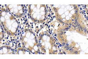 Immunohistochemistry (IHC) image for anti-BH3 Interacting Domain Death Agonist (BID) (AA 1-195) antibody (ABIN7432259)