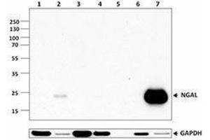 Western Blotting (WB) image for anti-Lipocalin 2 (LCN2) antibody (ABIN2665287) (Lipocalin 2 Antikörper)