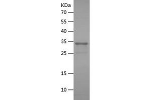 HSD17B3 Protein (AA 67-178) (His-IF2DI Tag)