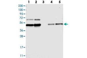 Western blot analysis of Lane 1: RT-4, Lane 2: U-251 MG, Lane 3: Human Plasma, Lane 4: Liver, Lane 5: Tonsil with FAM172A polyclonal antibody  at 1:250-1:500 dilution. (Fam172a Antikörper)