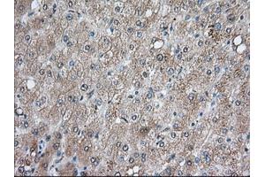 Immunohistochemical staining of paraffin-embedded Human prostate tissue using anti-BCL10 mouse monoclonal antibody. (BCL10 Antikörper)