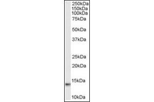 Image no. 1 for anti-Macrophage Migration Inhibitory Factor (Glycosylation-Inhibiting Factor) (MIF) (C-Term) antibody (ABIN374566) (MIF Antikörper  (C-Term))