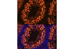 Immunofluorescence analysis of Rat testis cells using PIWIL1 antibody (ABIN3023049, ABIN3023050, ABIN3023051 and ABIN6219364) at dilution of 1:100. (PIWIL1 Antikörper)