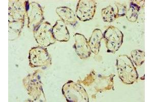 Immunohistochemistry of paraffin-embedded human placenta tissue using ABIN7153663 at dilution of 1:100 (Non-Syndromic Hearing Impairment Protein 5 (GSDME) (AA 1-260) Antikörper)