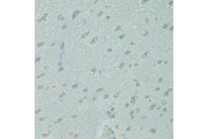 Immunohistochemistry of paraffin-embedded rat brain using NCOA2 antibody. (NCOA2 Antikörper)