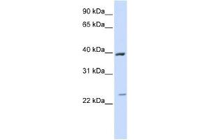 ACADL antibody used at 1 ug/ml to detect target protein. (ACADL Antikörper  (Middle Region))