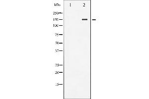 Western blot analysis of VEGFR2 phosphorylation expression in Na3VO4 treated HepG2 whole cell lysates,The lane on the left is treated with the antigen-specific peptide. (VEGFR2/CD309 Antikörper  (pTyr1214))