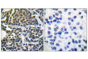 Immunohistochemistry (IHC) image for anti-Heat Shock Protein 90kDa alpha (Cytosolic), Class B Member 1 (HSP90AB1) (Ser254) antibody (ABIN1847890) (HSP90AB1 Antikörper  (Ser254))