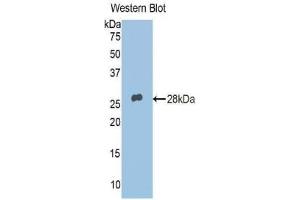 Detection of Recombinant ADRP, Human using Polyclonal Antibody to Adipose Differentiation Related Protein (ADRP) (ADRP Antikörper  (AA 5-232))