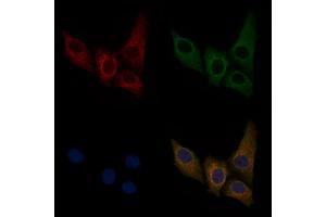 ABIN6256011 and ABIN6267476 staining HepG2 cells(30 min of 4uM Forskolin treatment) by IF/ICC. (Cadherin 5 Antikörper  (pTyr731))