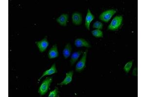 Immunofluorescence staining of A549 cells with ABIN7145367 at 1:133, counter-stained with DAPI. (B3GALT2 Antikörper  (AA 201-422))